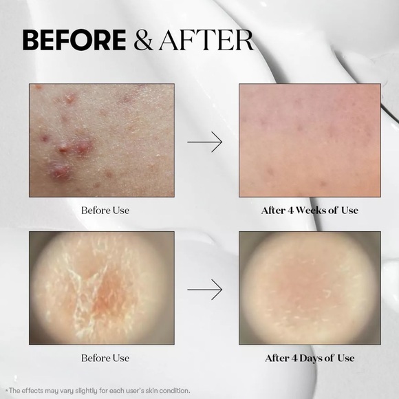 VT Cosmetics Reedle Shot 100 - Picture 3 of 13